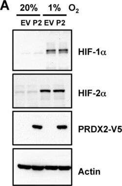 Peroxiredoxin 2 Antibody (4E10-2D2), Novus Biologicals 0.1 mg | Buy Online | Novus Biologicals | Fisher Scientific