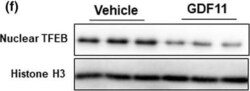TFEB Antibody (S1), Novus Biologicals 0.1 mg | Buy Online | Novus Biologicals | Fisher Scientific