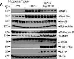 TFEB Antibody (S1), Novus Biologicals 0.1 mg | Buy Online | Novus Biologicals | Fisher Scientific