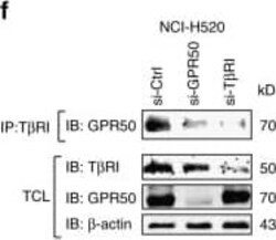 GPR50 Antibody, Novus Biologicals 0.05 mg | Buy Online | Novus Biologicals | Fisher Scientific