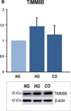 Novus Biologicals TIMM8B Antibody (8E5), Novus Biologicals 0.1 mg | Buy Online | Novus Biologicals&trade; | Fisher Scientific