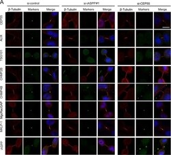 MgcRacGAP/RACGAP1 Antibody (1G6), Novus Biologicals 0.1 mg | Buy Online | Novus Biologicals | Fisher Scientific
