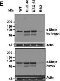 Ubiquilin 2 Antibody (5F5), Novus Biologicals 0.1 mg | Buy Online | Novus Biologicals | Fisher Scientific