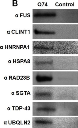 Ubiquilin 2 Antibody (5F5), Novus Biologicals 0.1 mg | Buy Online | Novus Biologicals | Fisher Scientific