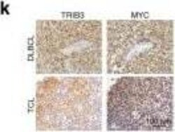 TRIB3 Antibody (1H2), Novus Biologicals 0.1 mg; Unconjugated:Antibodies,
