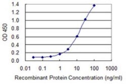 hCG beta 7 Antibody (6F12), Novus Biologicals 0.1 mg | Buy Online | Novus Biologicals | Fisher Scientific