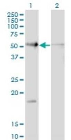 hHR23b Antibody (3H7), Novus Biologicals 0.1 mg | Buy Online | Novus Biologicals | Fisher Scientific