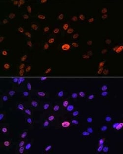 hnRNP A1 Rabbit anti-Human, Mouse, Rat, Clone: 10N0F4, Novus Biologicals:Antibodies:Primary