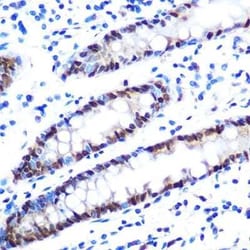 hnRNP A1 Rabbit anti-Human, Mouse, Rat, Clone: 10N0F4, Novus Biologicals:Antibodies:Primary