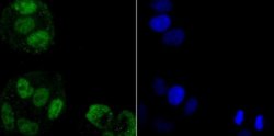 hnRNPA1 Rabbit anti-Human, Clone: JA39-21, Novus Biologicals 100&mu;L:Antibodies,