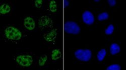 hnRNPA1 Rabbit anti-Human, Clone: JA39-21, Novus Biologicals 100&mu;L:Antibodies,
