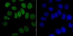 hnRNPA1 Rabbit anti-Human, Clone: JA39-21, Novus Biologicals 100&mu;L:Antibodies,