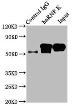 hnRNP K Antibody (3G7), Novus Biologicals 100 &mu;g | Buy Online | Novus Biologicals | Fisher Scientific