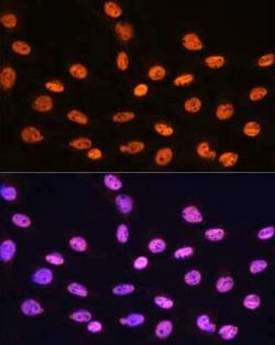 hnRNP K Rabbit anti-Human, Mouse, Rat, Clone: 3O5Y4, Novus Biologicals