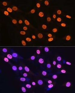 hnRNP K Rabbit anti-Human, Mouse, Rat, Clone: 3O5Y4, Novus Biologicals