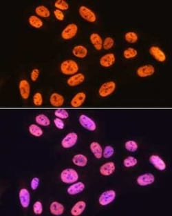 hnRNP K Rabbit anti-Human, Mouse, Rat, Clone: 3O5Y4, Novus Biologicals