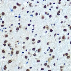 hnRNP K Rabbit anti-Human, Mouse, Rat, Clone: 3O5Y4, Novus Biologicals