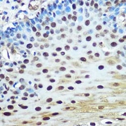 hnRNP K Rabbit anti-Human, Mouse, Rat, Clone: 3O5Y4, Novus Biologicals