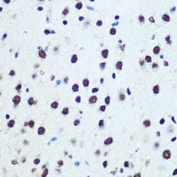 hnRNP K Rabbit anti-Human, Mouse, Rat, Clone: 3O5Y4, Novus Biologicals