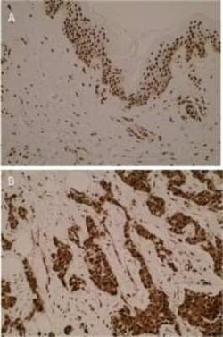 hnRNP K Antibody (N10 P2D3 G2) - BSA Free, Novus Biologicals:Antibodies:Primary