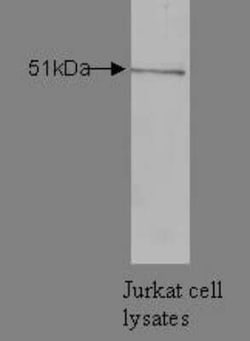 hnRNP K Antibody (N10 P2D3 G2) - BSA Free, Novus Biologicals:Antibodies:Primary