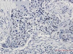 hnRNP K/J Rabbit anti-Human, Mouse, Rat, Clone: S07-5H0, Novus Biologicals