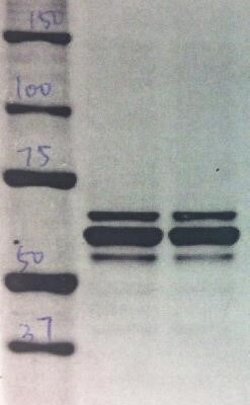 hnRNP L Antibody (4D11) - Azide and BSA Free, Novus Biologicals 0.1 mL;