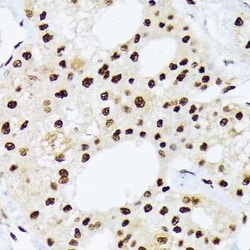 hnRNP-Q Rabbit anti-Human, Mouse, Rat, Clone: 1R0G5, Novus Biologicals