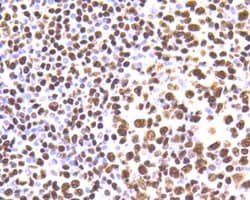 hnRNP U Rabbit anti-Human, Mouse, Rat, Clone: JB23-43, Novus Biologicals