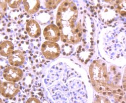 hnRNP U Rabbit anti-Human, Mouse, Rat, Clone: JB23-43, Novus Biologicals