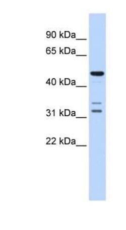 htrA4 Antibody, Novus Biologicals 100 &mu;g; Unconjugated:Antibodies, Polyclonal