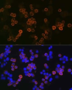 iNOS Rabbit anti-Mouse, Clone: 3L0U6, Novus Biologicals 100 &mu;g | Buy Online | Novus Biologicals | Fisher Scientific