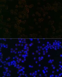 iNOS Rabbit anti-Mouse, Clone: 3L0U6, Novus Biologicals 100 &mu;g | Buy Online | Novus Biologicals | Fisher Scientific