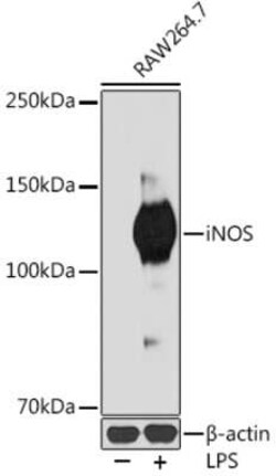 iNOS Rabbit anti-Mouse, Clone: 3L0U6, Novus Biologicals 100 &mu;g | Buy Online | Novus Biologicals | Fisher Scientific