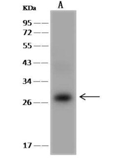 integrin beta 4 binding protein Antibody, Novus Biologicals 100 &mu;g;