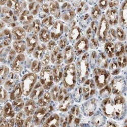 mGluR1 Antibody, Novus Biologicals 0.1 mL; Unconjugated:Antibodies, Polyclonal