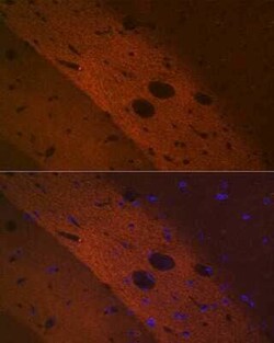 mGluR2 Rabbit anti-Mouse, Rat, Clone: 0U6B5, Novus Biologicals 100 &mu;g;