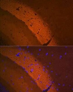 mGluR2 Rabbit anti-Mouse, Rat, Clone: 0U6B5, Novus Biologicals 100 &mu;g;