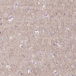 mGluR2 Antibody, Novus Biologicals 0.1 mL, Unconjugated:Antibodies, Polyclonal