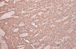 mGluR5 Antibody, Novus Biologicals 100 &mu;g | Buy Online | Bio-Techne | Fisher Scientific