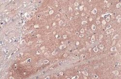 mGluR5 Antibody, Novus Biologicals 100 &mu;g | Buy Online | Bio-Techne | Fisher Scientific