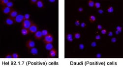 Human Phospho-CROCC (S1476) Antibody, R D Systems:Antibodies:Primary Antibodies