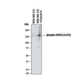 Human Phospho-CROCC (S1476) Antibody, R D Systems:Antibodies:Primary Antibodies