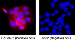 Human Mesothelin Antibody, R D Systems:Antibodies:Primary Antibodies