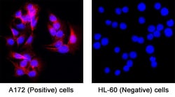 Human SNAP25 Antibody, R D Systems:Antibodies:Primary Antibodies