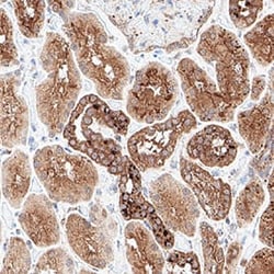 Human VHL Antibody, R D Systems 25 &mu;g; Unconjugated:Antibodies, Monoclonal