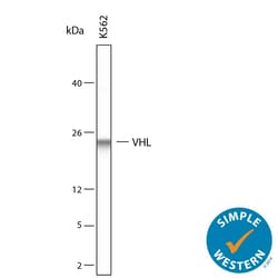 Human VHL Antibody, R D Systems:Antibodies:Primary Antibodies