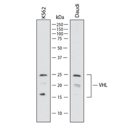 Human VHL Antibody, R D Systems:Antibodies:Primary Antibodies