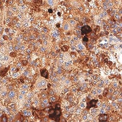 Human G6PD Antibody, R D Systems 100 &mu;g; Unconjugated:Antibodies, Monoclonal