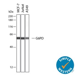 Human G6PD Antibody, R D Systems 100 &mu;g; Unconjugated:Antibodies, Monoclonal